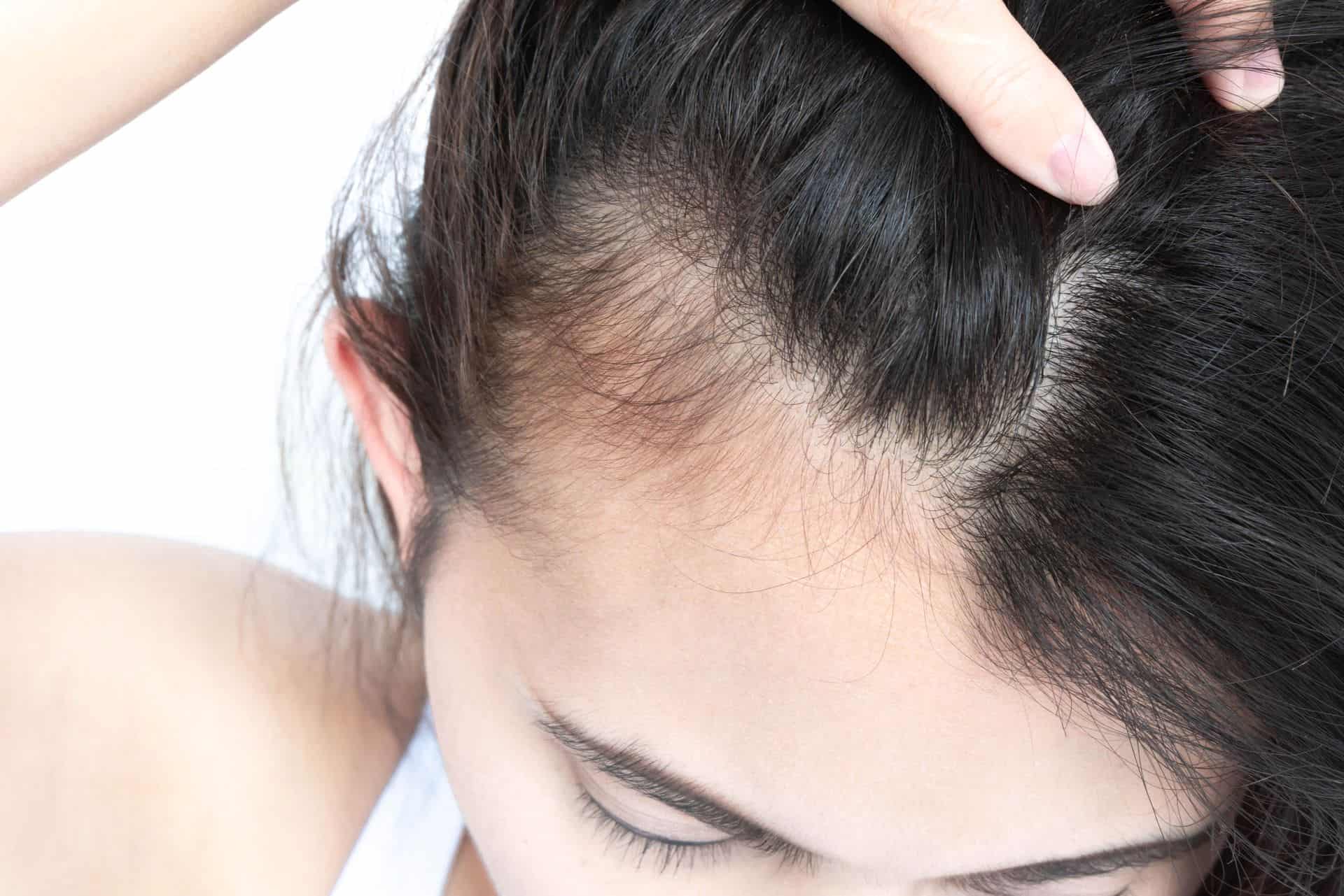 Les Causes De La Chute De Cheveux Chez Les Femmes